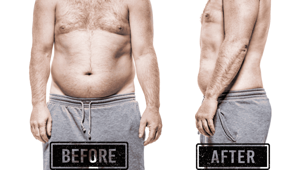 Liposuction Before And After: What To Expect
